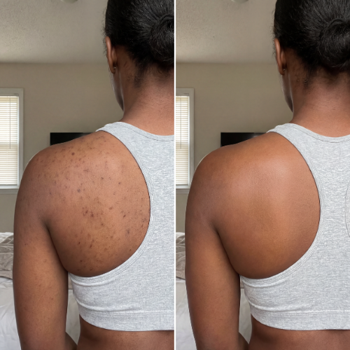 Velaros™ Black Seed Oil Body Coverage Perfector