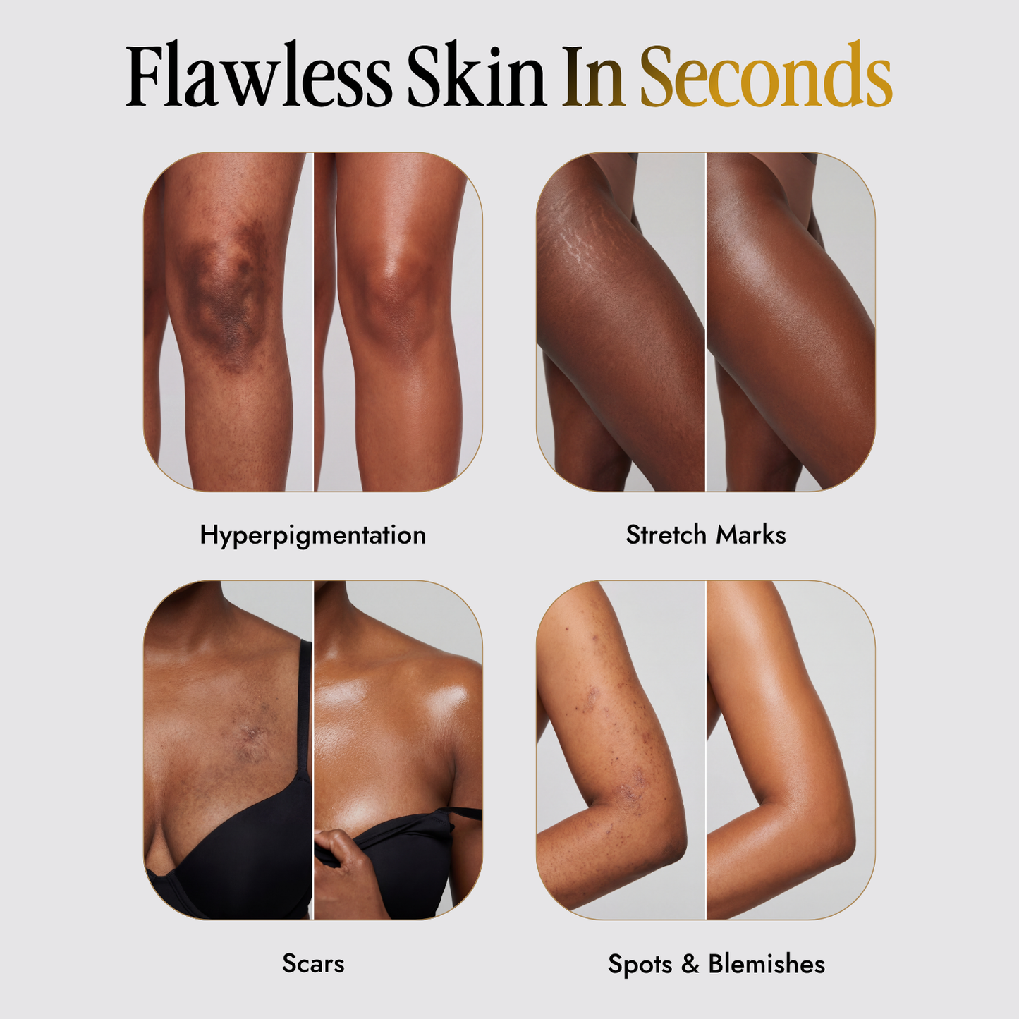 Velaros™ Black Seed Oil Body Coverage Perfector