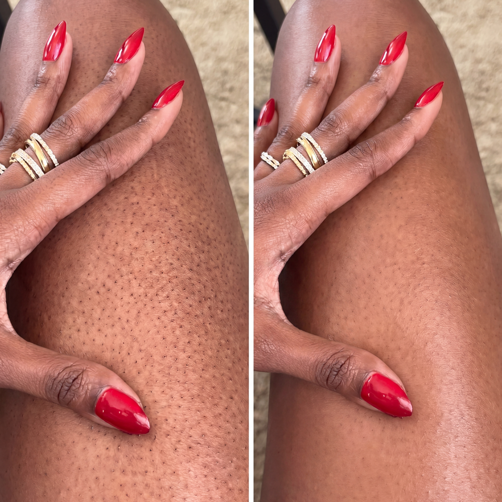 Velaros™ Black Seed Oil Body Coverage Perfector