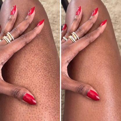 Velaros™ Black Seed Oil Body Coverage Perfector