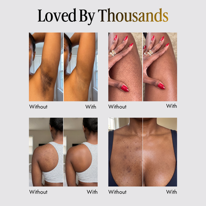 Velaros™ Black Seed Oil Body Coverage Perfector