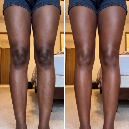 Velaros™ Black Seed Oil Body Coverage Perfector